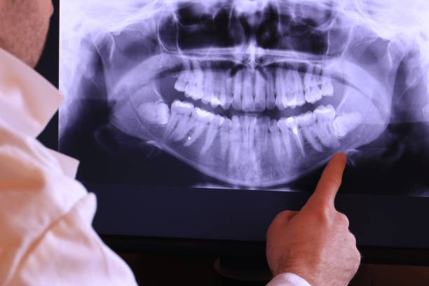Best Urgent Tooth Repair  in Devine, TX
