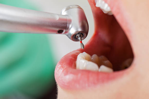 Best Broken Tooth Emergency  in Devine, TX